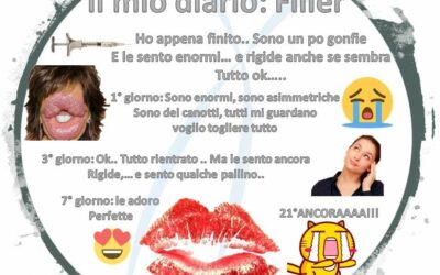 Il diario del filler alle labbra –