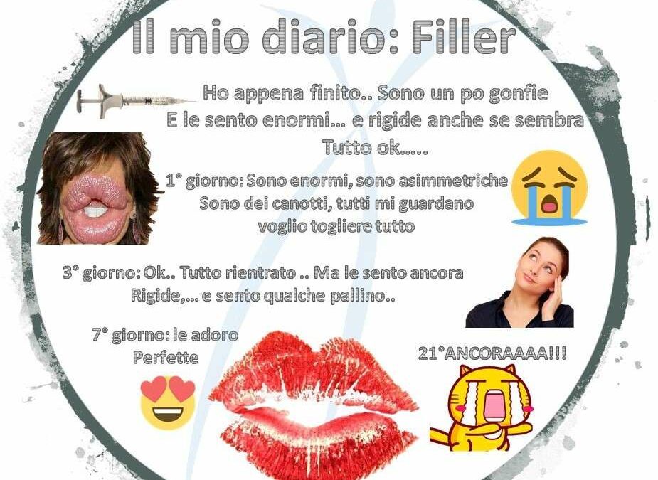 Il diario del filler alle labbra –