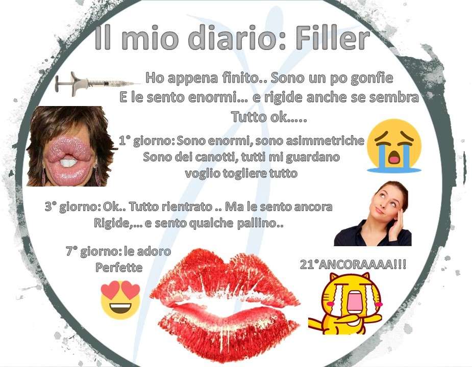 cosa aspettarsi da un filler labbra